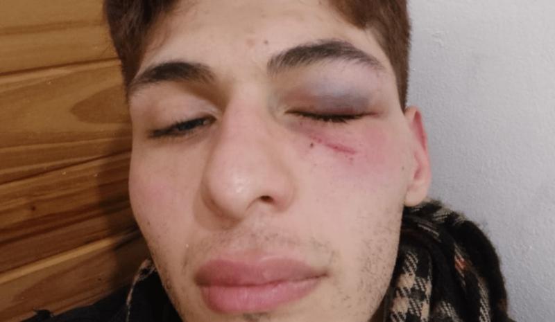 INADI Buenos Aires condenó la agresión sufrida en La Plata por un joven no binario con síndrome de Asperger.